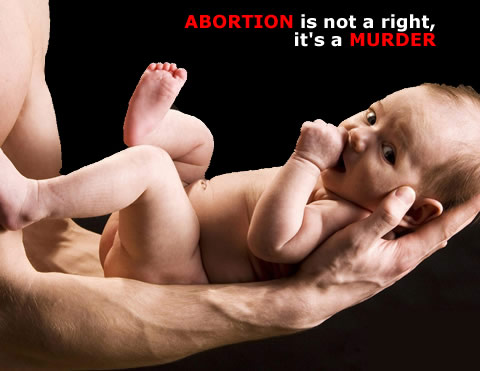 El aborto no es un derecho, es un asesinato.