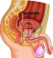 Prostate